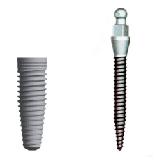 Tulsa Affordable Dental Implants