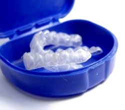 Tulsa Teeth Whitening Trays
