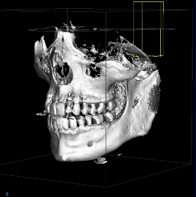 An image of a ct x-ray