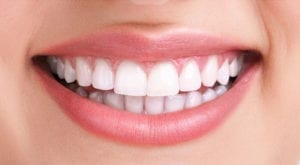 an attractive white smile