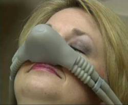 A woman wearing a nose piece for nitrous oxide