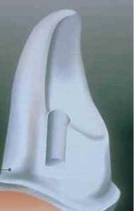Tooth preparation for a Maryland Bridge